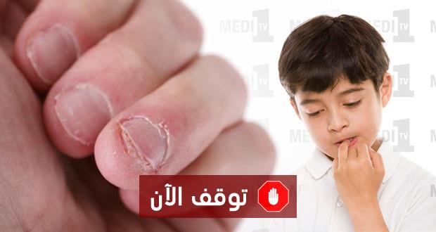 اضغط على الصورة لرؤيتها بالحجم الطبيعي