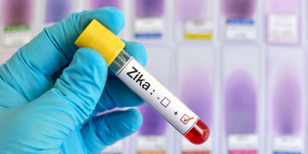 تشكيل طاقم من الخبراء الطبيين لابتكار عقاقير ضد فيروس "زيكا"