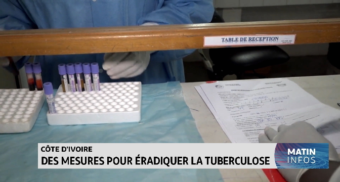 Côte d’Ivoire : des mesures pour éradiquer la tuberculose