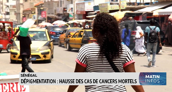 Dépigmentation : Hausse des cas de cancers mortels au Sénégal