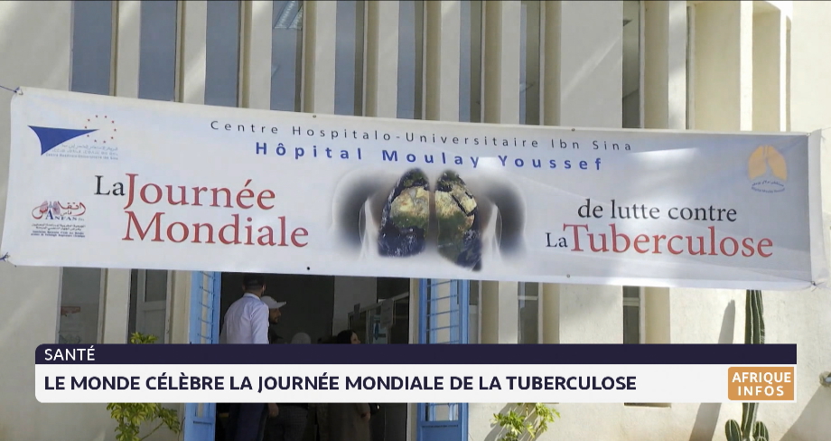 Le monde célèbre la Journée mondiale de lutte contre la tuberculose
