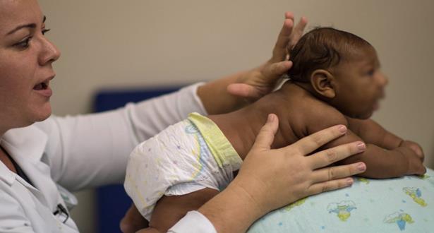 Medi1news Zika Naissance En Espagne D Un Bebe Atteint De Microcephalie Le Premier Cas En Europe Medi1news Zika Naissance En Espagne D Un Bebe Atteint De Microcephalie Le Premier Cas En Europe