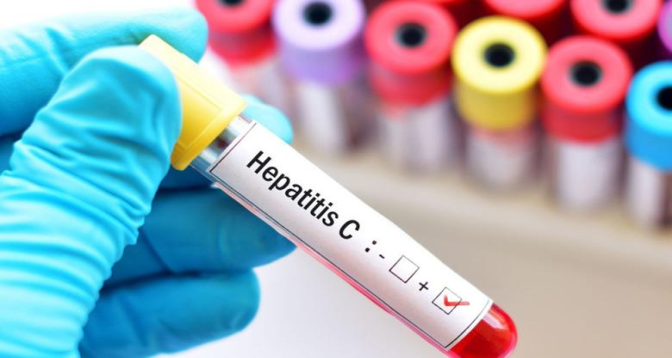 L’OMS alerte sur la hausse des décès liés aux virus de l’hépatite