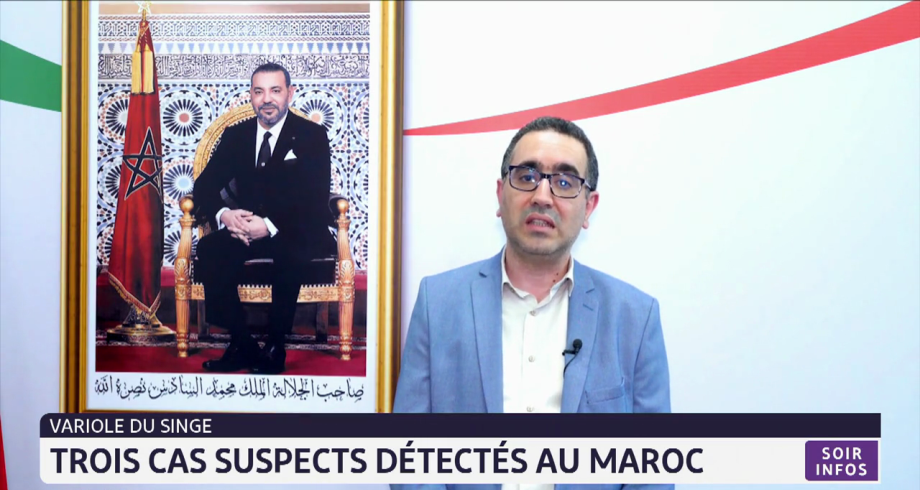 Variole du singe: trois cas suspects détectés au Maroc