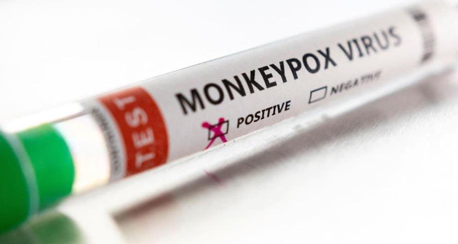 شركة أدوية تطور فحوص PCR لكشف الإصابة عن فيروس جدري القردة