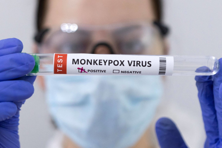 OMS: 1392 cas suspectés et 44 cas confirmés de variole du singe en 2022 en Afrique 