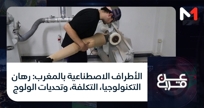عن قرب > الأطراف الاصطناعية بالمغرب: رهان التكنولوجيا، التكلفة، وتحديات الولوج