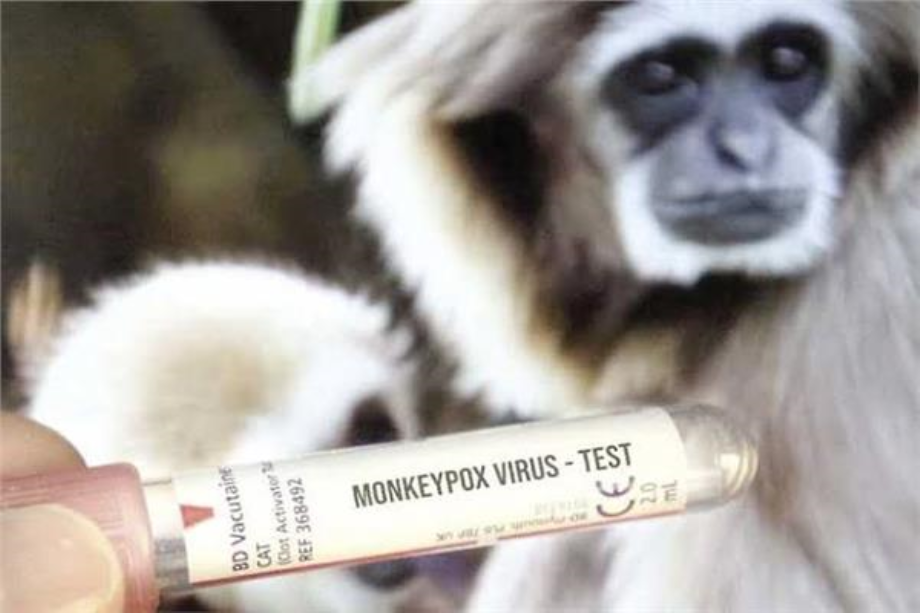 أمريكا: طريقة حقن جديدة للقاح جدري القردة

