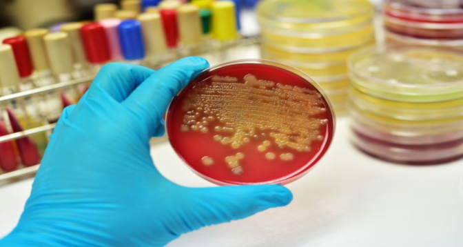 USA: détection d'une bactérie causant une grave maladie infectieuse 


